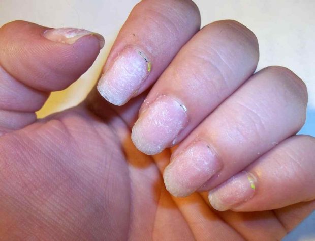 keep your nails safe
