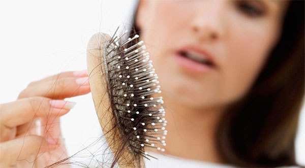 Five Things You Can Do To Prevent Hair Loss