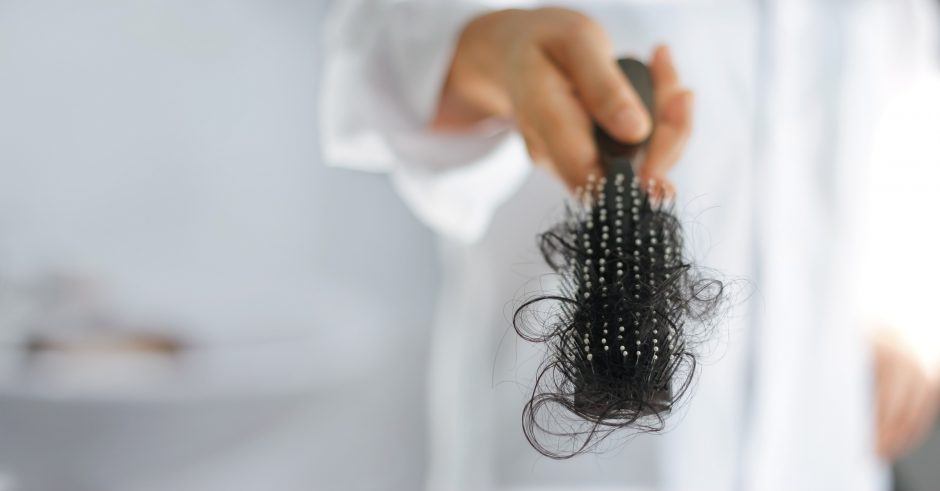main causes of hair loss