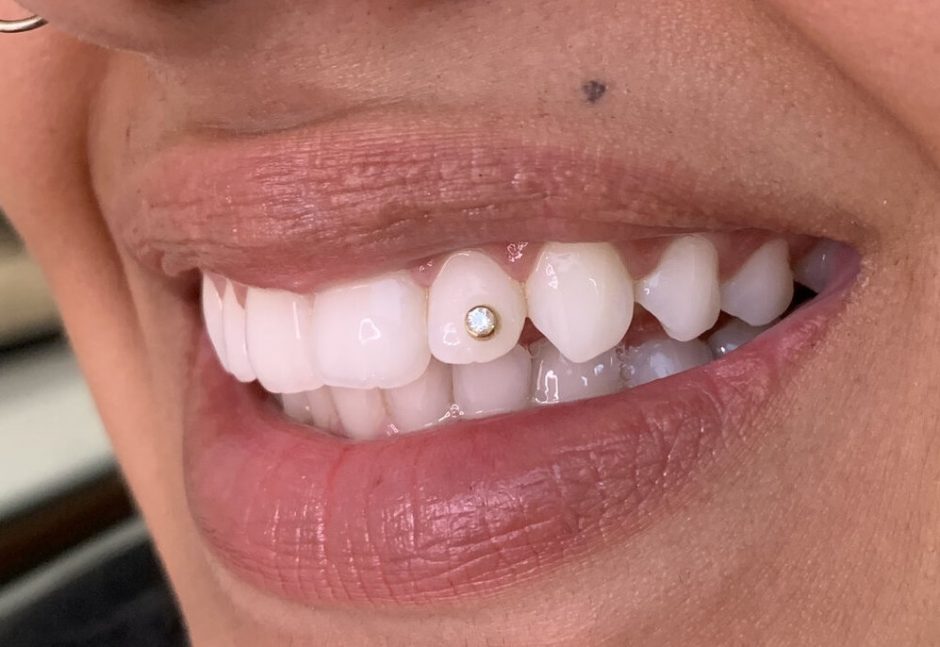 Everything You Should Know About a Tooth Piercing - Sheeba Magazine