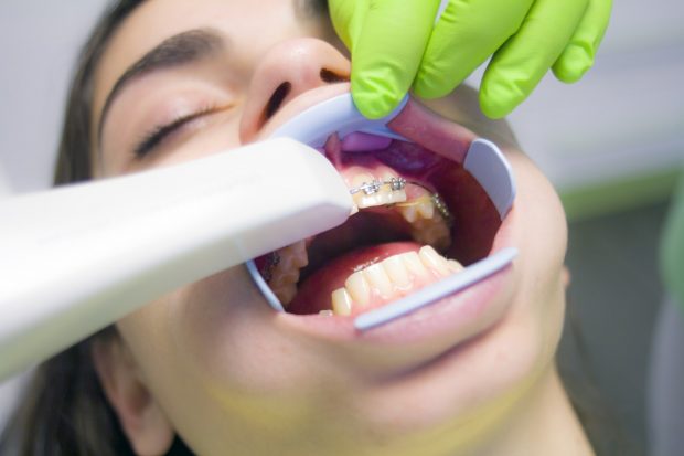These Cosmetic Dentistry Treatments