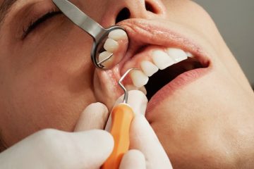 dental restoration treatments