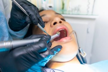 good dentist in hamilton