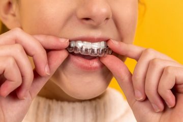 Signs that Your Teen Needs Invisalign