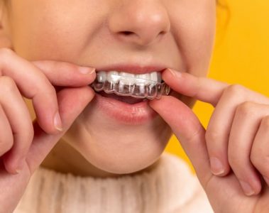 Signs that Your Teen Needs Invisalign