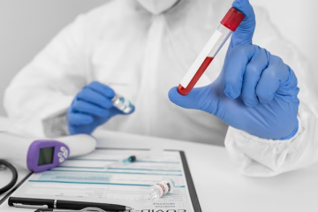 Role of Blood Tests