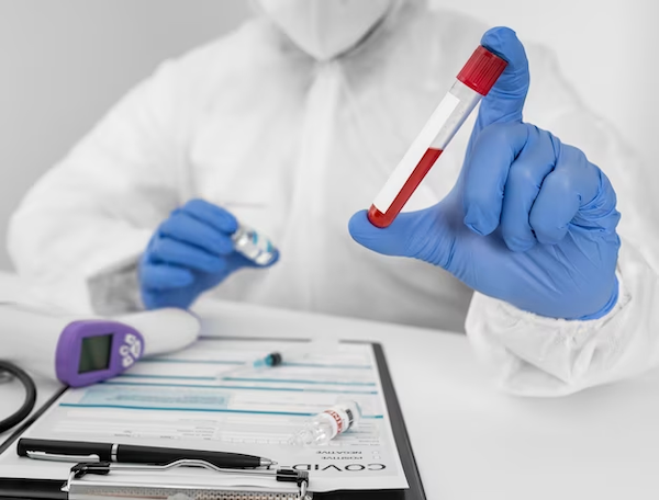 Role of Blood Tests