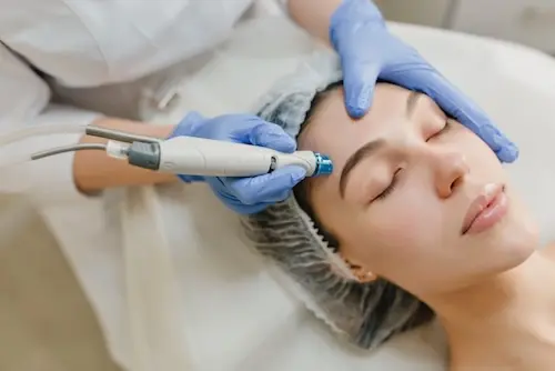 laser treatments for healthy looking skin